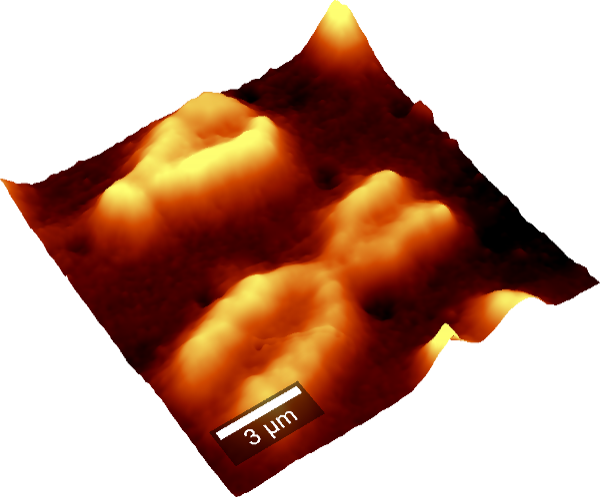 ヒト染色体のAFM画像