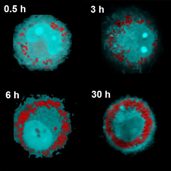 マクロファージ内の脂質滴